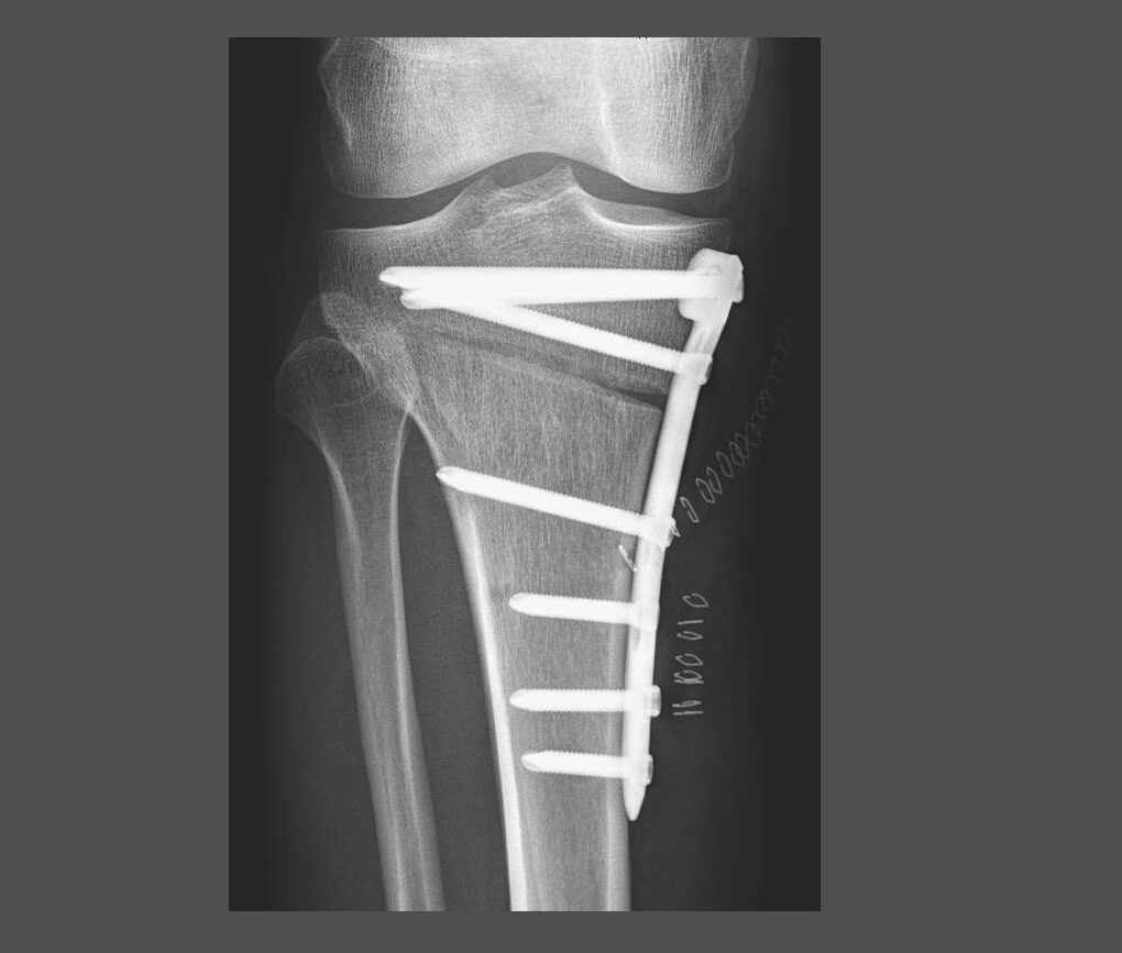 Operative Orthopädie in Potsdam